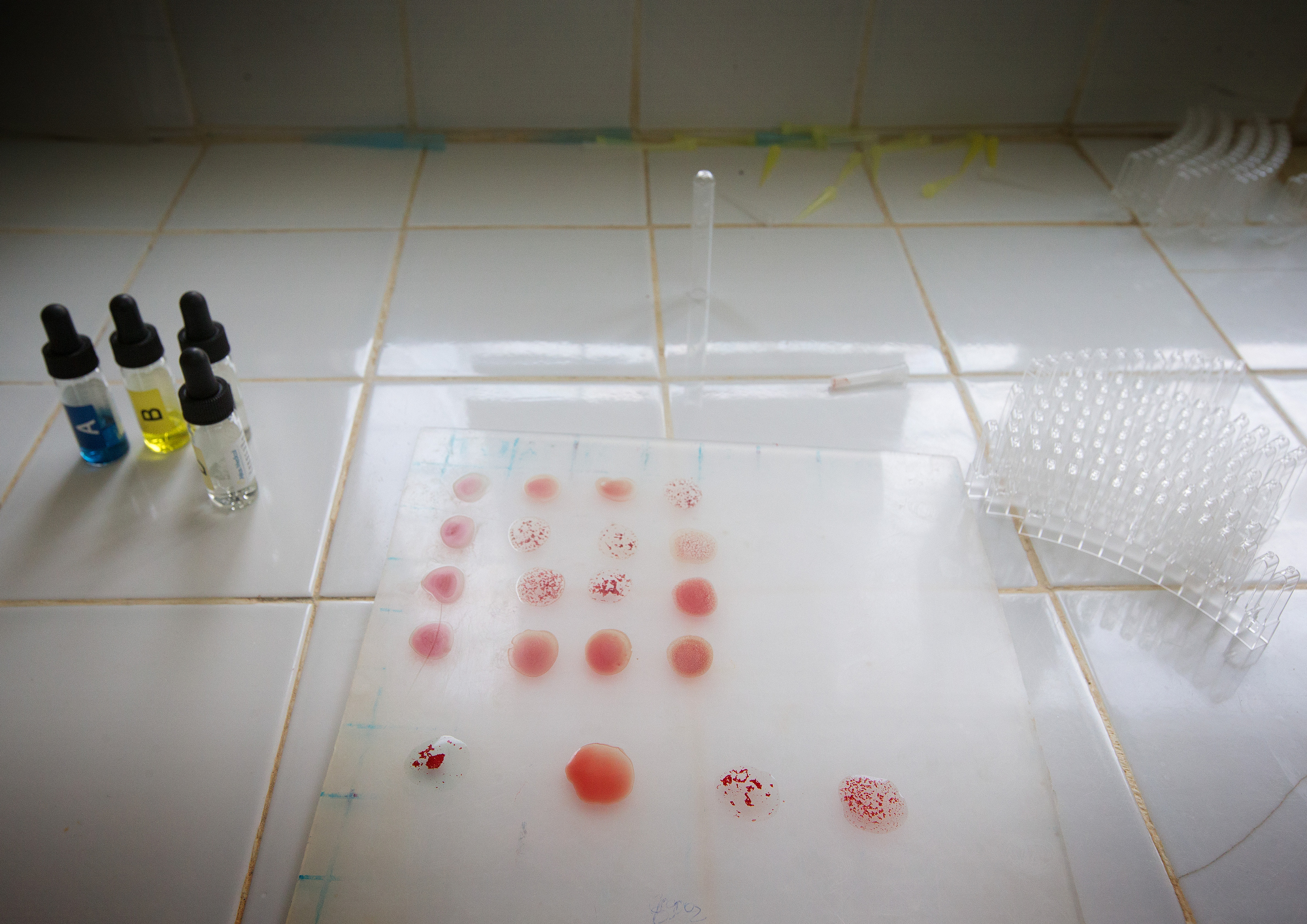 Blood samples await testing in the laboratory at Dabou Methodist Hospital.