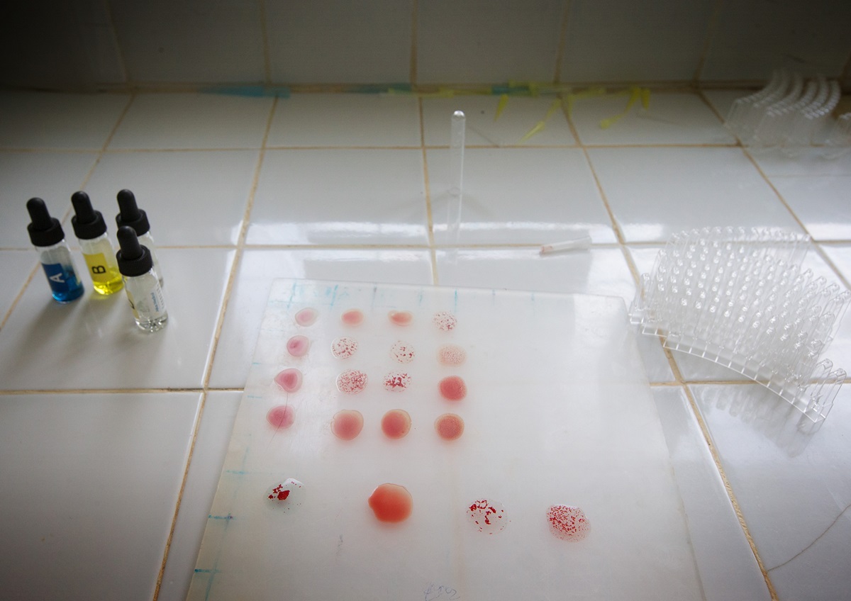 Blood samples await testing in the laboratory at Dabou Methodist Hospital.