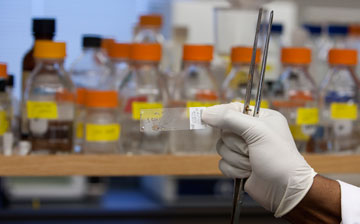 Dr. Donald J. Alcendor prepares a slide with a sample of diseased brain tissue at Meharry Medical College in Nashville, Tenn. Alcendor is a professor at the Center for AIDS Health Disparities Research at Meharry.