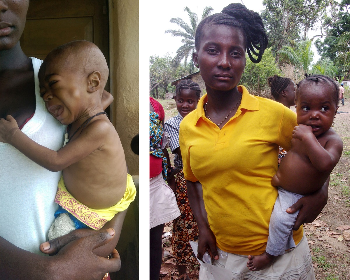 “Baby Betty” is one of United Methodist Mercy Hospital’s success stories. The photo at left shows the child when she was first seen at the clinic. Mohamed Khadar, the hospital’s outreach manager, says she was severely malnourished and sick with pneumonia. She was treated and put on a special diet. The photo at right shows her now, over 2 years old and healthy. Photos courtesy of Phileas Jusu and Mercy Hospital. “Baby Betty” is one of United Methodist Mercy Hospital’s success stories. The photo at left shows the child when she was first seen at the clinic. Mohamed Khadar, the hospital’s outreach manager, says she was severely malnourished and sick with pneumonia. She was treated and put on a special diet. The photo at right shows her now, over 2 years old and healthy. Photos courtesy of Phileas Jusu and Mercy Hospital.